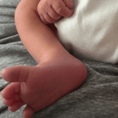 Neonato